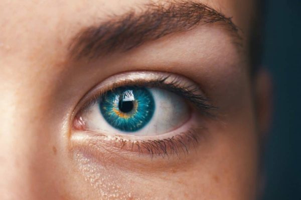 Close up of a girl wearing Orthokeratology lens