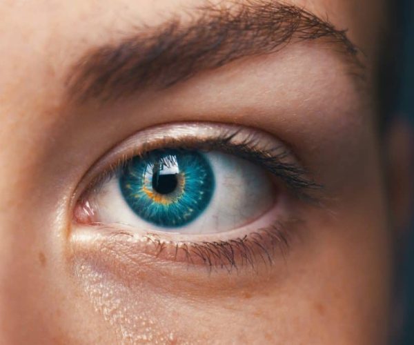 Close up of a girl wearing Orthokeratology lens